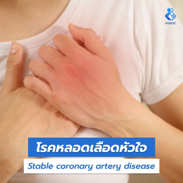 โรคหลอดเลือดหัวใจ
(Stable coronary artery disease)