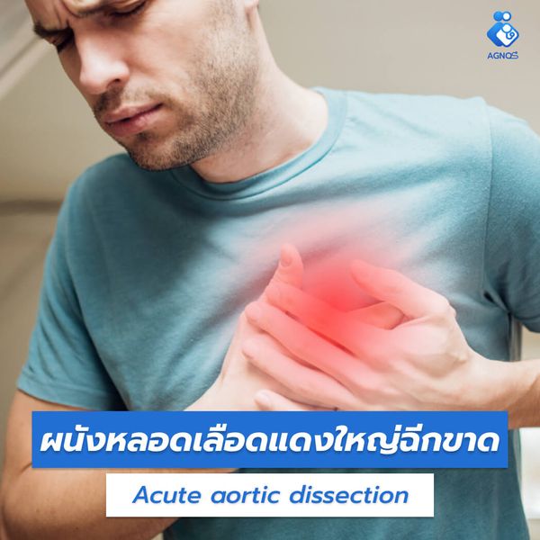 ผนังหลอดเลือดแดงใหญ่ฉีกขาด
(Acute aortic dissection)