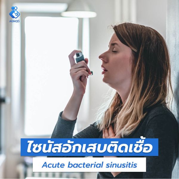 ไซนัสอักเสบติดเชื้อ (Acute
bacterial sinusitis)