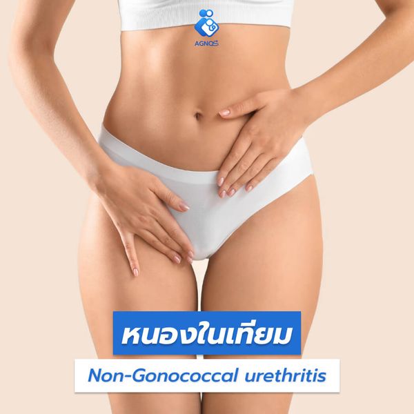 หนองในเทียม (Non-Gonococcal
    urethritis)