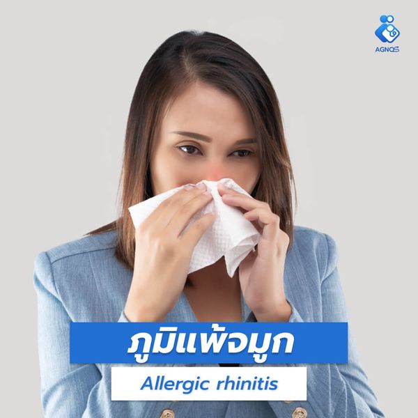 โรคภูมิแพ้จมูก (Allergic
rhinitis)
