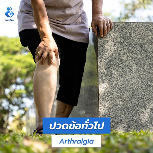 ปวดข้อทั่วไป (Arthralgia)