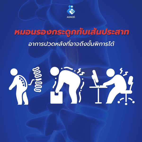 อาการปวดหลังอาจถึงขั้นพิการได้