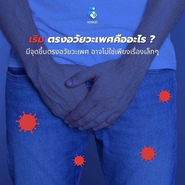 เริมตรงอวัยวะเพศ